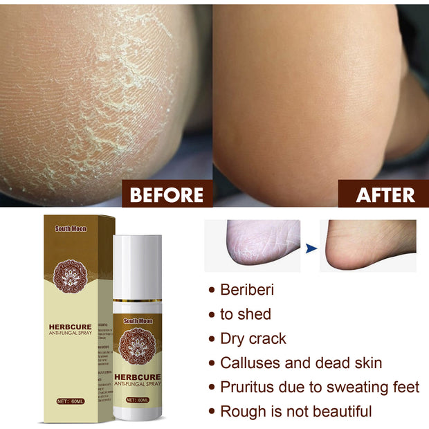 Herbal Foot Spray