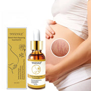 Stretch Marks Remover Essential Oil Skin Care Treatment Cream Maternity Repair Anti-Aging Anti-Winkle Firming Anti-Slackline Oil