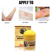 50G Psoriasis Eczma Cream Works Perfect For All Kinds Of Skin Problems Patch Body Massage Ointment Chinese Herbal Medicine